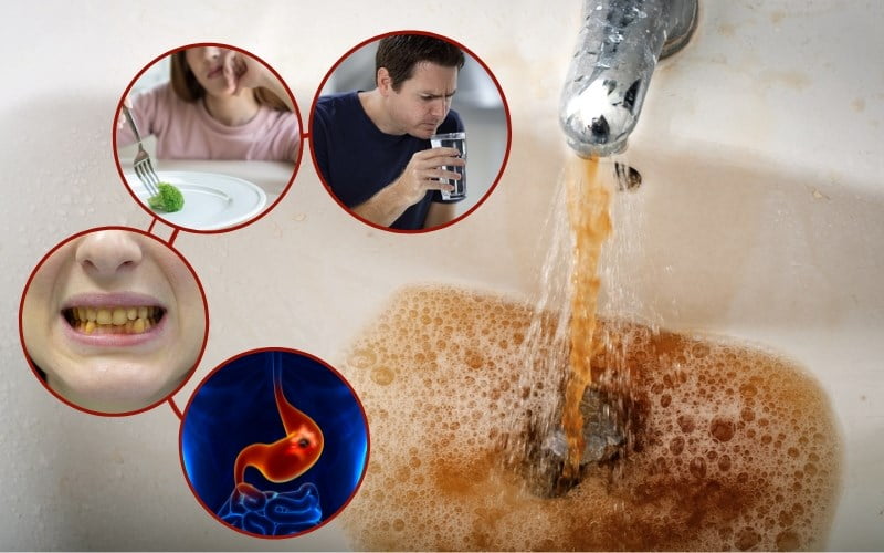 Bộ Lọc nước phèn Bộ Lọc nước phèn